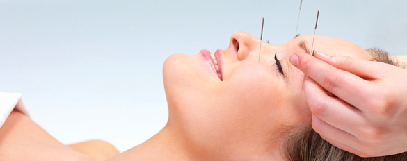 Carnival Cruise Line Acupuncture.png